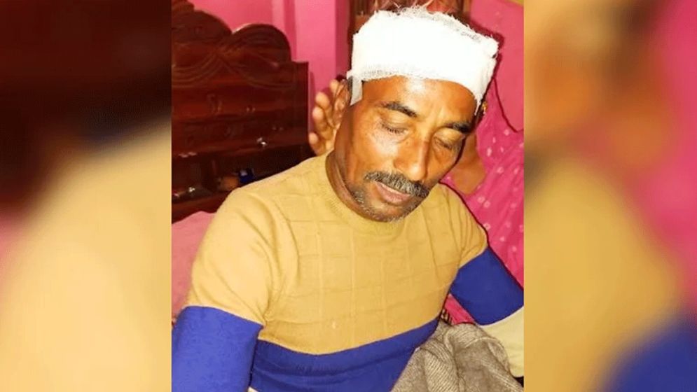 হাতুড়িপেটায় আহত সেই যুবদল কর্মীর মৃত্যু